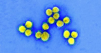 Coronavirus