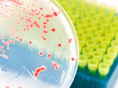 Patogenos alimentarios